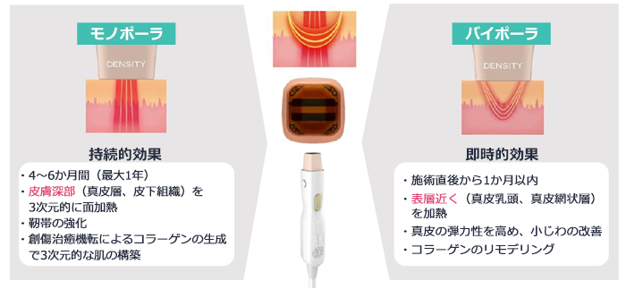 DENSITY IMG